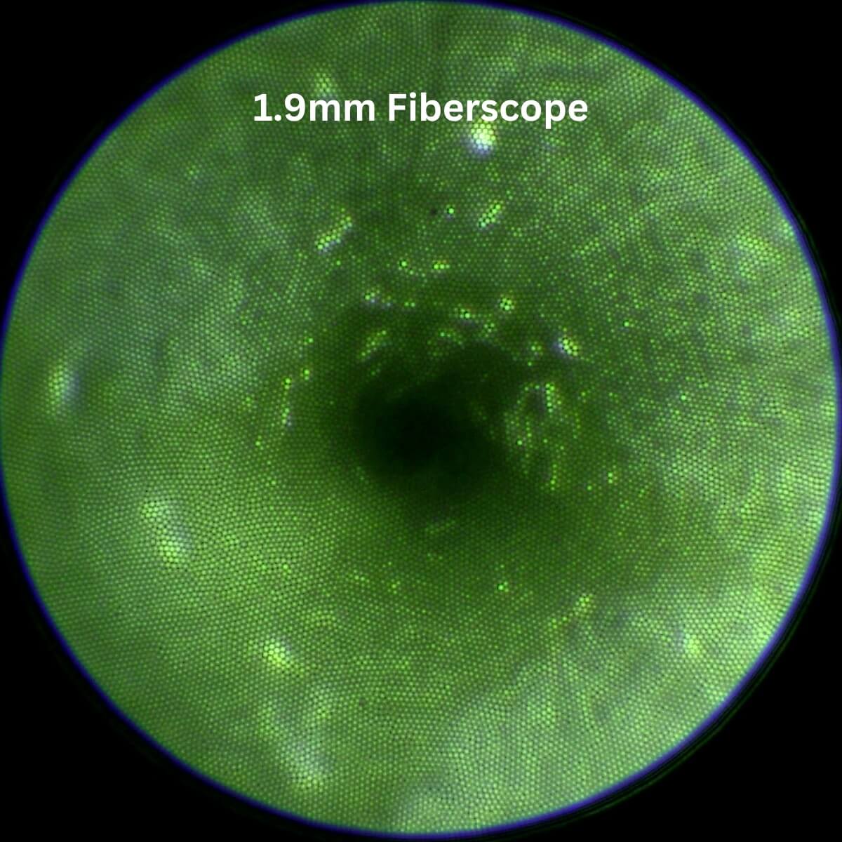 Image Capture with 1.9mm Fiberscope