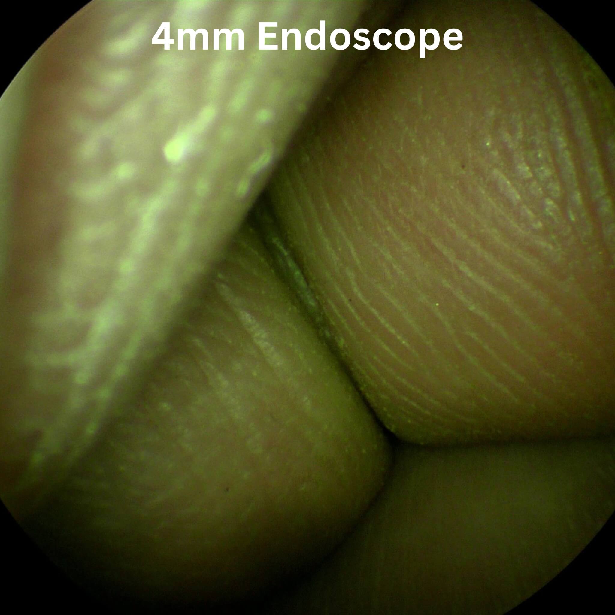 Footage Captured with USB Endoscope Camera ImagePRO USB 3.0