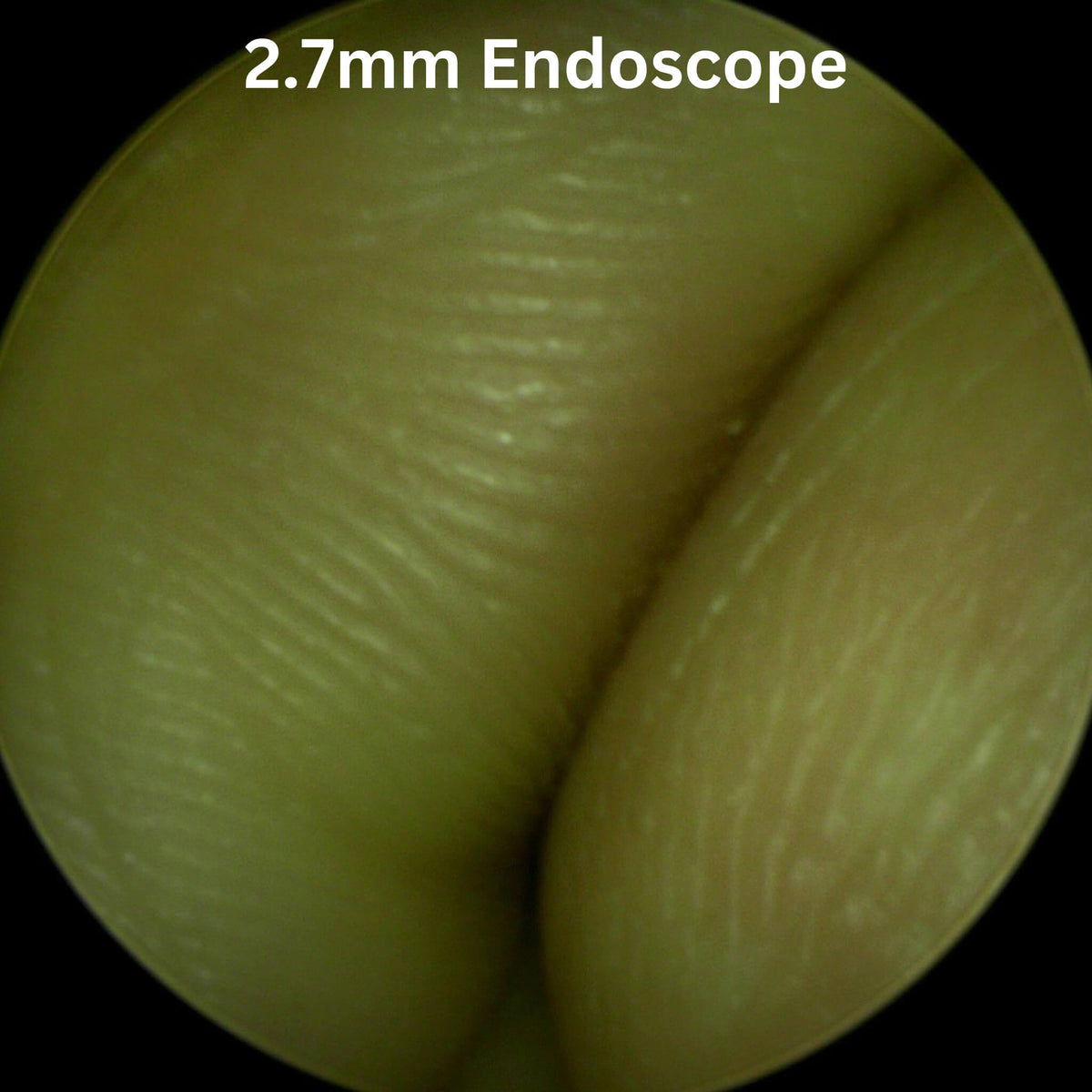 Endoscopy Camera ImagePRO USB 3.0
