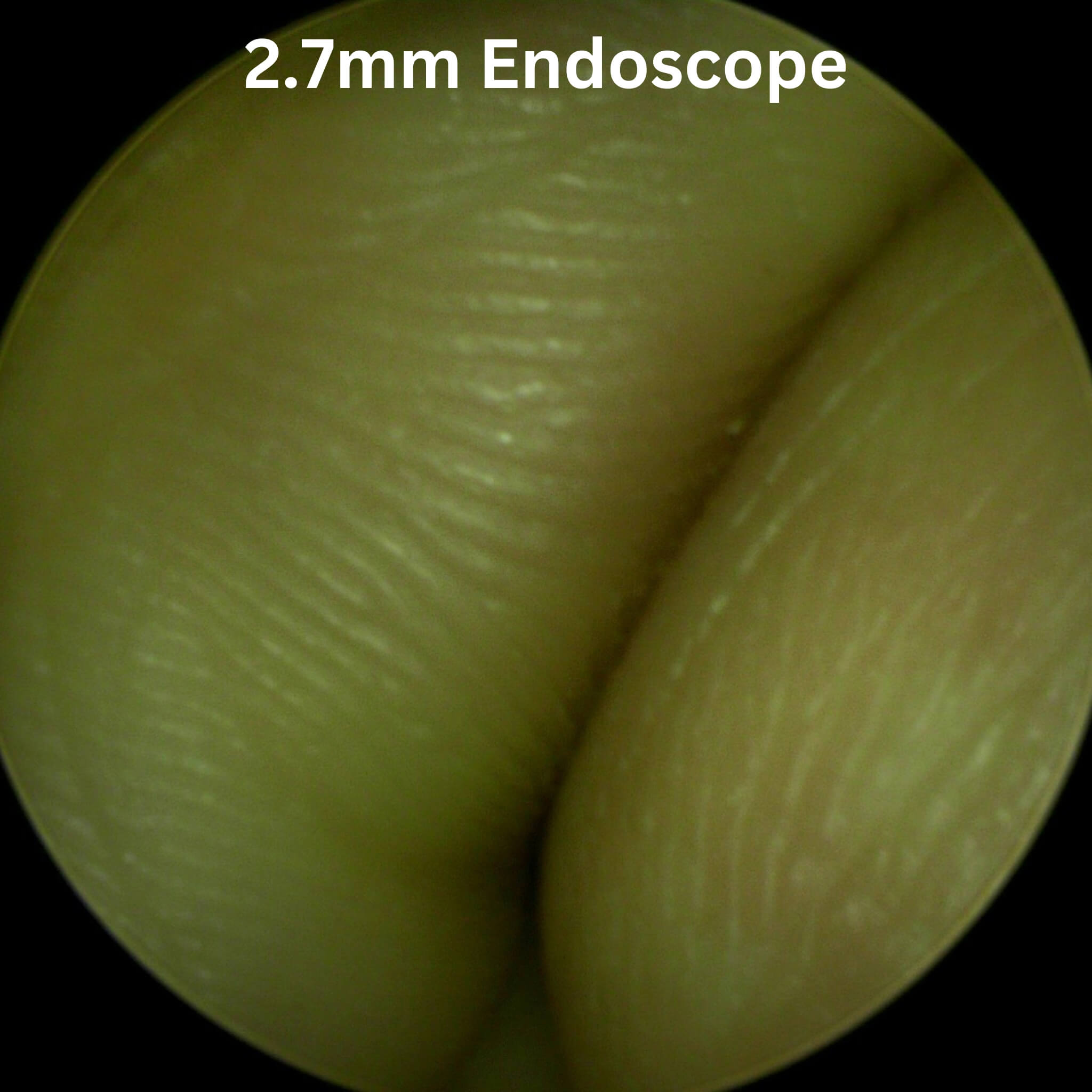 Footage taken with a ImagePRO USB 3.0 Endoscope Camera