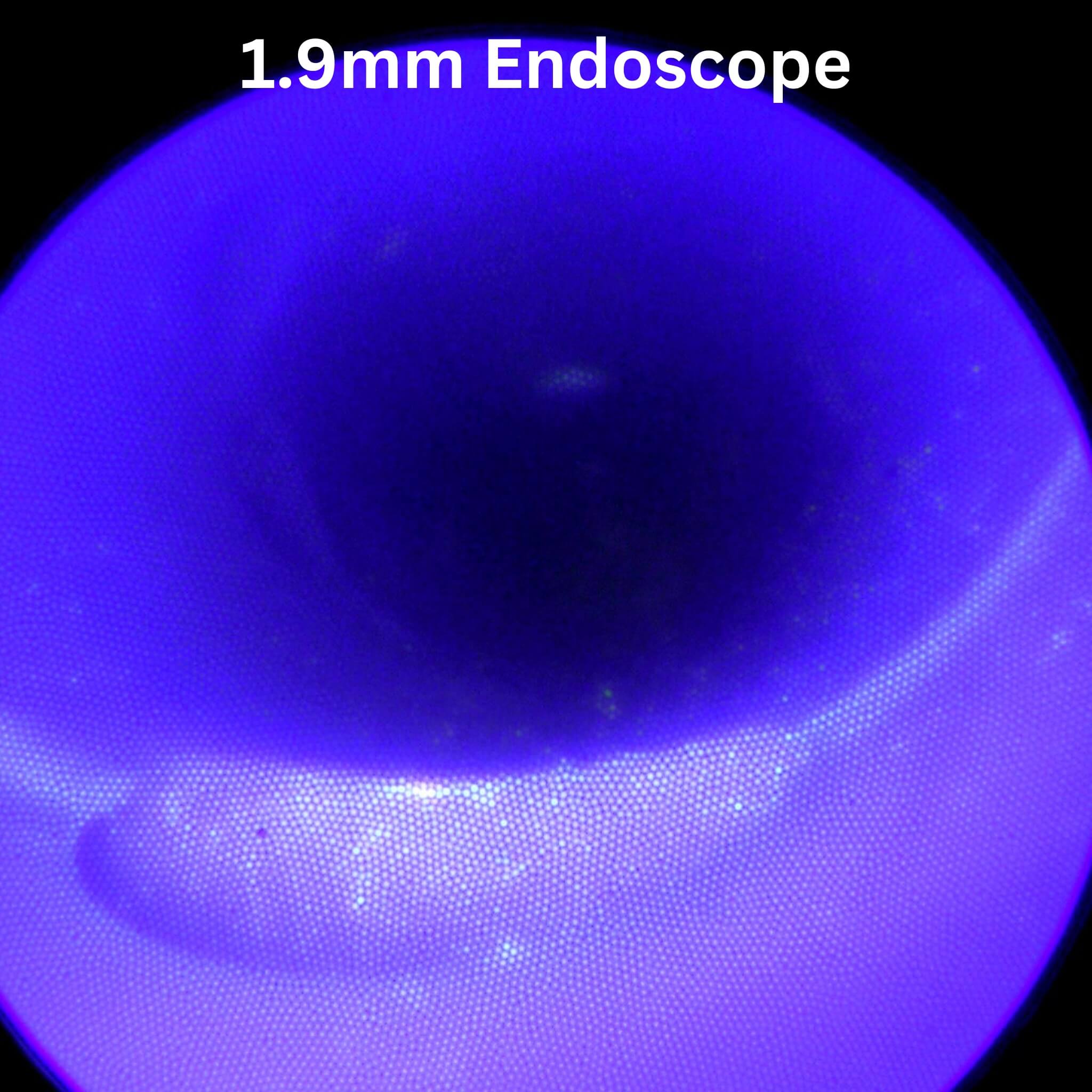 Capture made with ImagePRO USB 3.0 Endoscope Camera