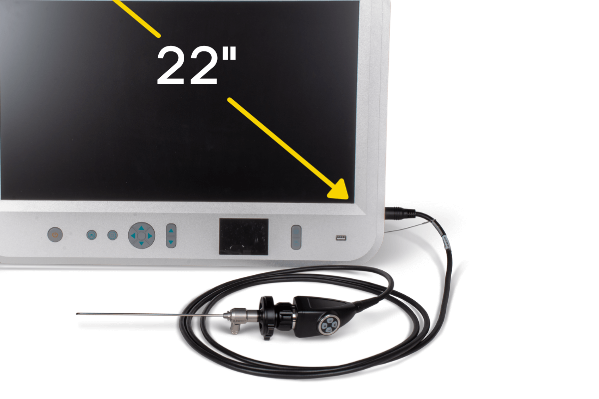 Endoscopy Camera with Large Monitor