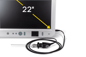 Endoscopy Camera with Large Monitor